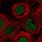Anti-TNFRSF10A Antibody