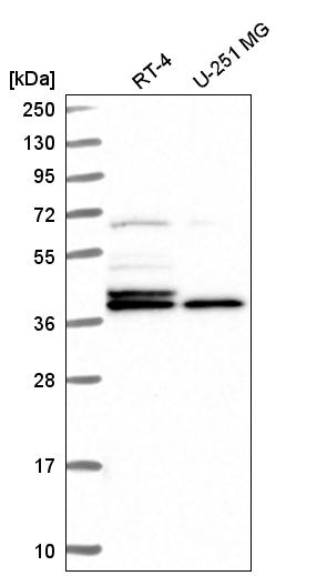 Anti-H2AFY Antibody