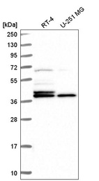 Anti-H2AFY Antibody