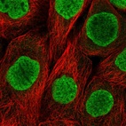 Immunofluorescent staining of human cell line A-431 shows localization to nucleoplasm.
