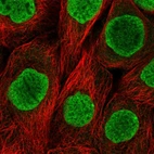 Immunofluorescent staining of human cell line A-431 shows localization to nucleoplasm.