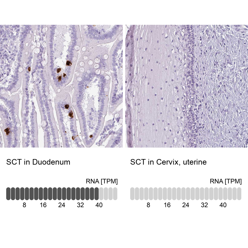 Anti-SCT Antibody