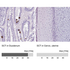 Anti-SCT Antibody