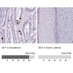 Anti-SCT Antibody