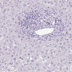 Immunohistochemical staining of human liver shows negative cytoplasmic positivity in hepatocytes as expected.