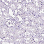 Immunohistochemical staining of human kidney shows negative cytoplasmic positivity in cells in tubules as expected.