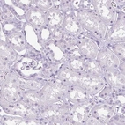 Immunohistochemical staining of human kidney shows negative cytoplasmic positivity in cells in tubules as expected.