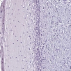 Immunohistochemical staining of human cervix, uterine shows negative cytoplasmic positivity in squamous epithelial cells as expected.