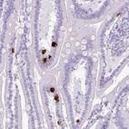 Immunohistochemical staining of human duodenum shows strong cytoplasmic positivity in endocrine glandular cells.