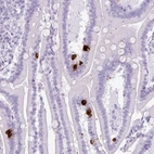 Immunohistochemical staining of human duodenum shows strong cytoplasmic positivity in endocrine glandular cells.