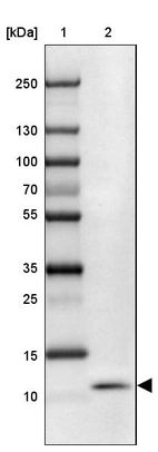Lane 1: Marker [kDa] 250, 130, 100, 70, 55, 35, 25, 15, 10_br/_Lane 2: Human Esophagus tissue