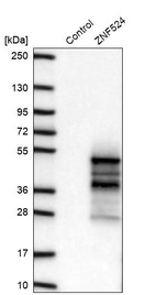 Western blot analysis in control (vector only transfected HEK293T lysate) and ZNF524 over-expression lysate (Co-expressed with a C-terminal myc-DDK tag (~3.1 kDa) in mammalian HEK293T cells, LY407148).
