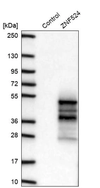 Western blot analysis in control (vector only transfected HEK293T lysate) and ZNF524 over-expression lysate (Co-expressed with a C-terminal myc-DDK tag (~3.1 kDa) in mammalian HEK293T cells, LY407148).
