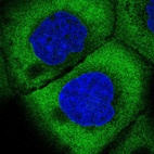 Immunofluorescent staining of human cell line A-431 shows localization to cytosol.