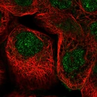 Immunofluorescent staining of human cell line A-431 shows localization to nucleoplasm.