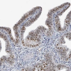 Immunohistochemical staining of human fallopian tube shows moderate nuclear and weak cytoplasmic positivity in glandular cells.