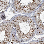 Immunohistochemical staining of human testis shows moderate to strong nuclear positivity in cells in seminiferous ducts.