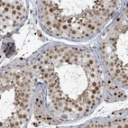 Immunohistochemical staining of human testis shows moderate to strong nuclear positivity in cells in seminiferous ducts.