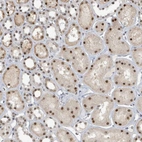 Immunohistochemical staining of human kidney shows strong nuclear and moderate cytoplasmic positivity in cells in tubules.