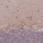Immunohistochemical staining of human cerebellum shows weak to moderate cytoplasmic positivity in cells in molecular layer.