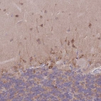Immunohistochemical staining of human cerebellum shows weak to moderate cytoplasmic positivity in cells in molecular layer.