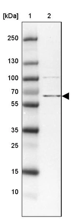 Lane 1: Marker [kDa] 250, 130, 100, 70, 55, 35, 25, 15, 10_br/_Lane 2: Human Tonsil tissue