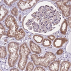 Immunohistochemical staining of human kidney shows moderate cytoplasmic positivity in cells in tubules.