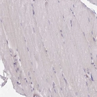 Immunohistochemical staining of human skeletal muscle shows no positivity in myocytes as expected.