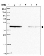 Lane 1: Marker [kDa] 250, 130, 95, 72, 55, 36, 28, 17, 10_br/_Lane 2: Human cell line RT-4_br/_Lane 3: Human cell line U-251MG sp_br/_Lane 4: Human plasma (IgG/HSA depleted)_br/_Lane 5: Human liver tissue_br/_Lane 6: Human tonsil tissue