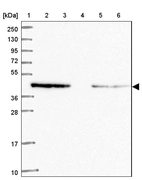 Lane 1: Marker [kDa] 250, 130, 95, 72, 55, 36, 28, 17, 10_br/_Lane 2: Human cell line RT-4_br/_Lane 3: Human cell line U-251MG sp_br/_Lane 4: Human plasma (IgG/HSA depleted)_br/_Lane 5: Human liver tissue_br/_Lane 6: Human tonsil tissue