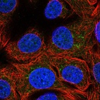 Immunofluorescent staining of human cell line MCF7 shows localization to the Golgi apparatus.