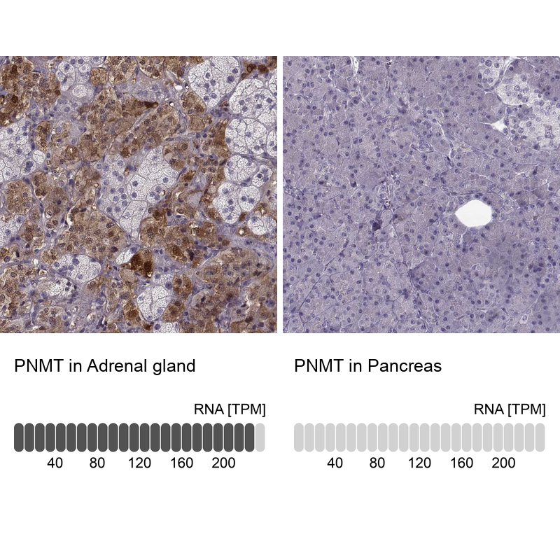 Anti-PNMT Antibody