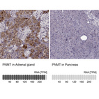 Anti-PNMT Antibody