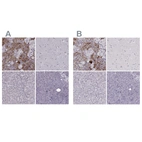 Immunohistochemical staining of human adrenal gland, cerebral cortex, liver and pancreas using Anti-PNMT antibody HPA051005 (A) shows similar protein distribution across tissues to independent antibody HPA043412 (B).