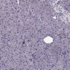 Immunohistochemical staining of human pancreas shows no positivity in exocrine glandular cells as expected.
