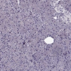 Immunohistochemical staining of human pancreas shows no positivity in exocrine glandular cells as expected.