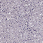 Anti-PNMT Antibody