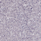 Immunohistochemical staining of human liver shows no positivity in hepatocytes as expected.