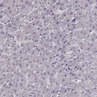 Immunohistochemical staining of human liver shows no positivity in hepatocytes as expected.