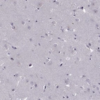 Immunohistochemical staining of human cerebral cortex shows no positivity in neurons as expected.
