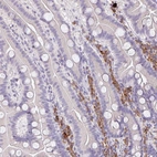 Anti-ZNF215 Antibody