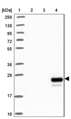 Lane 1: Marker [kDa] 250, 130, 95, 72, 55, 36, 28, 17, 10_br/_Lane 2: Human cell line RT-4_br/_Lane 3: Human cell line U-251MG sp_br/_Lane 4: Human plasma (IgG/HSA depleted)