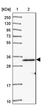 Lane 1: Marker [kDa] 250, 130, 95, 72, 55, 36, 28, 17, 10_br/_Lane 2: Human cell line RT-4
