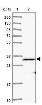 Lane 1: Marker [kDa] 250, 130, 95, 72, 55, 36, 28, 17, 10_br/_Lane 2: Human cell line RT-4