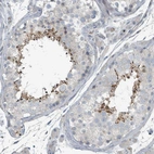 Anti-SLC44A5 Antibody