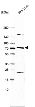 Western blot analysis in human cell line SH-SY5Y.