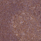 Anti-GGA1 Antibody