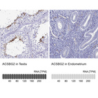 Anti-ACSBG2 Antibody