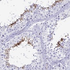 Immunohistochemical staining of human testis shows high expression.