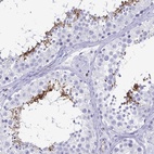 Anti-ACSBG2 Antibody